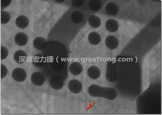 BGA因?yàn)楹笁|變小，造成錫膏過多而最終形成焊接短路的結(jié)果。